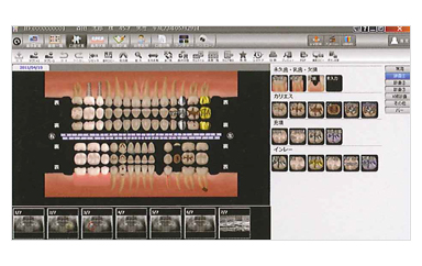 患者様説明ソフト